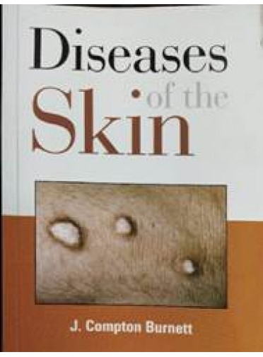 DISEASES OF THE SKIN